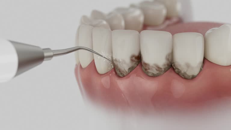 Reliable Dental contractor in Frankfort, MI by Dentist Open Now